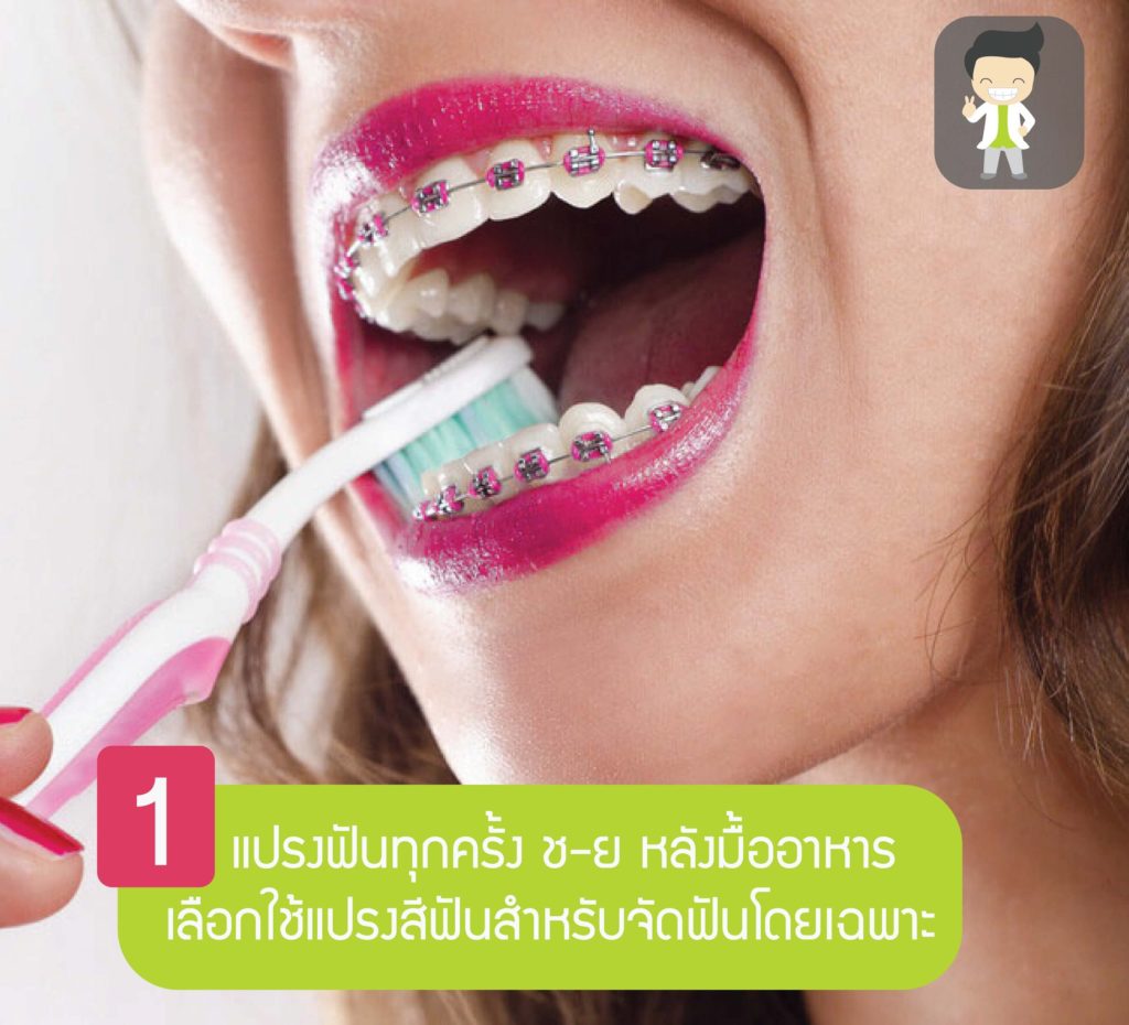 ยิ้มสวยไม่สะดุด! กับ 5 เคล็ดลับง่ายๆ ดูแลช่องปากสำหรับคนจัดฟัน 2 33713246 2062980037251381 3757975012519182336 o